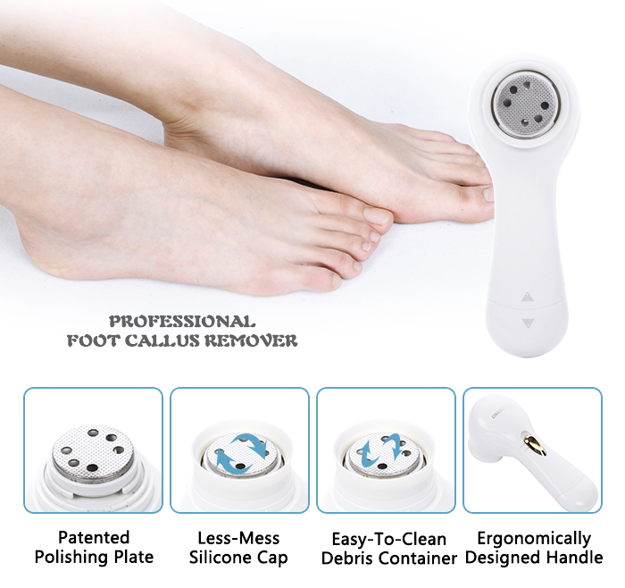 Ele-Callus Remover